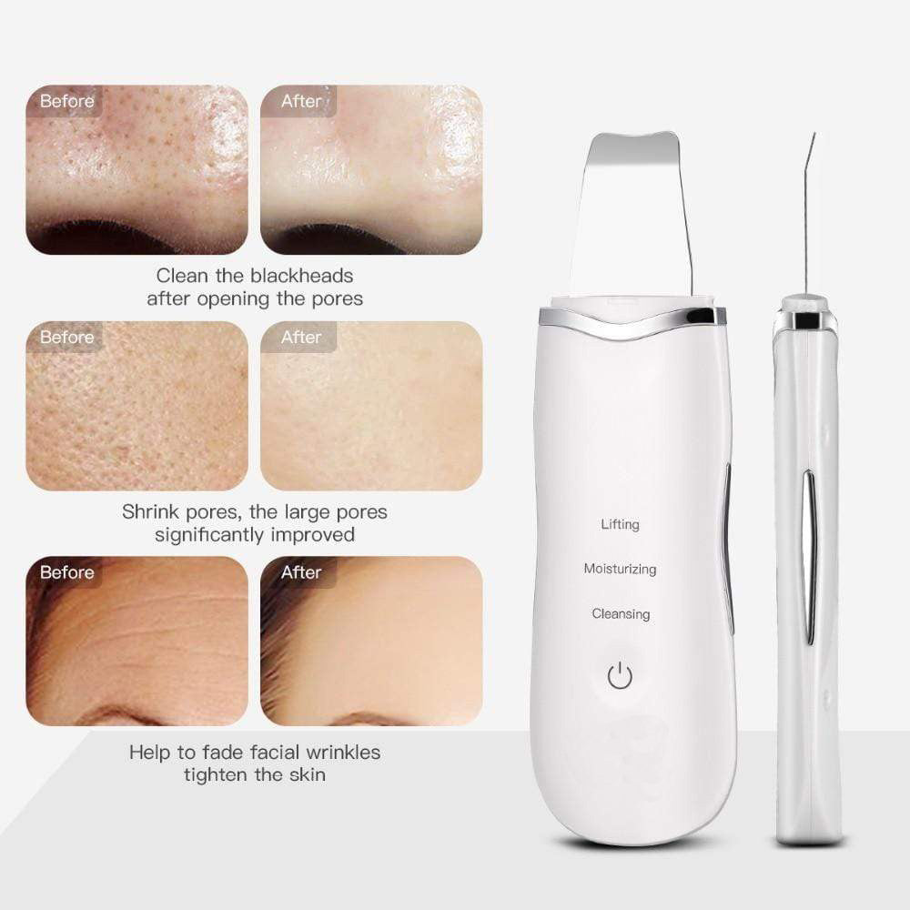 Ultrasonic Facial Scrubber – Deep Cleansing & Skin Smoothing Tool