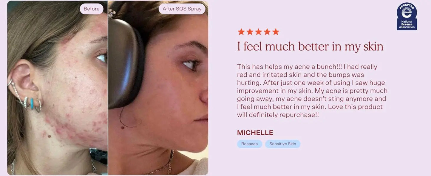 Tower 28 Beauty SOS Daily Rescue Facial Spray