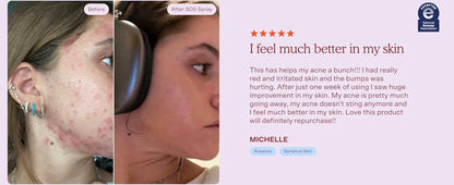 Tower 28 Beauty SOS Daily Rescue Facial Spray