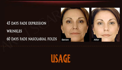 ARTISCARE Six Peptides Face Serum 5pcs/Lot