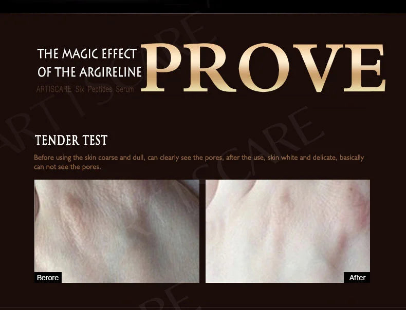 ARTISCARE Six Peptides Face Serum 5pcs/Lot