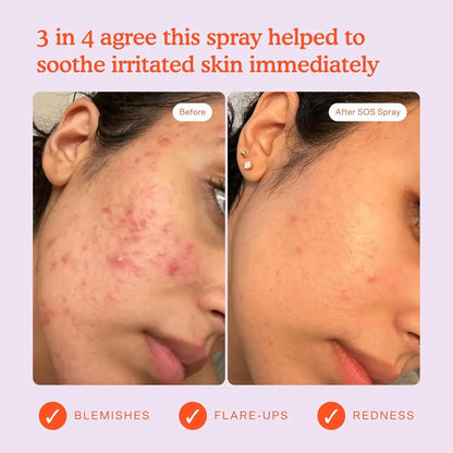 Tower 28 Beauty SOS Daily Rescue Facial Spray