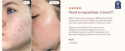 Tower 28 Beauty SOS Daily Rescue Facial Spray